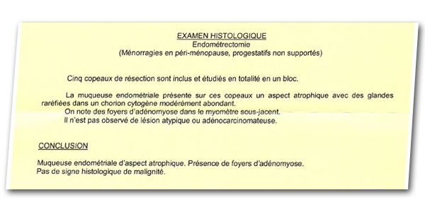 cr anatomopathologie adenomyose